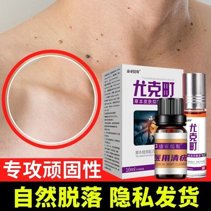 跖疣膏猴子刺猴手部肉粒疙瘩脚部老茧鸡眼颈部肉刺丝状寻常去除液