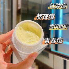 首蔻祛痘调理霜祛痘调理霜去痘膏淡化痘印闭口粉刺祛痘女学生