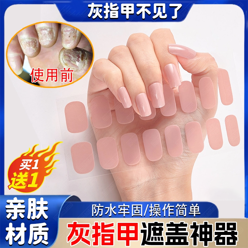 灰指甲遮丑贴男女夏季遮挡保护套