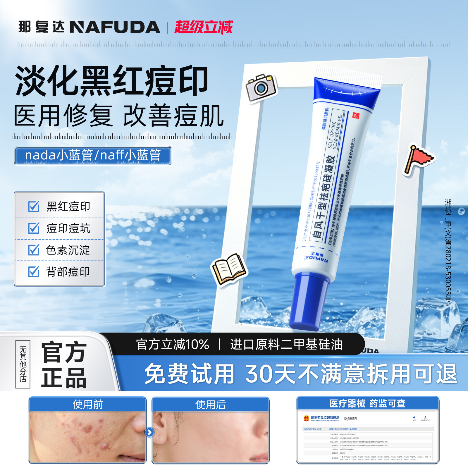 （活动新链接）naff小蓝管nada小蓝管淡化复达小蓝管痘印痘痘