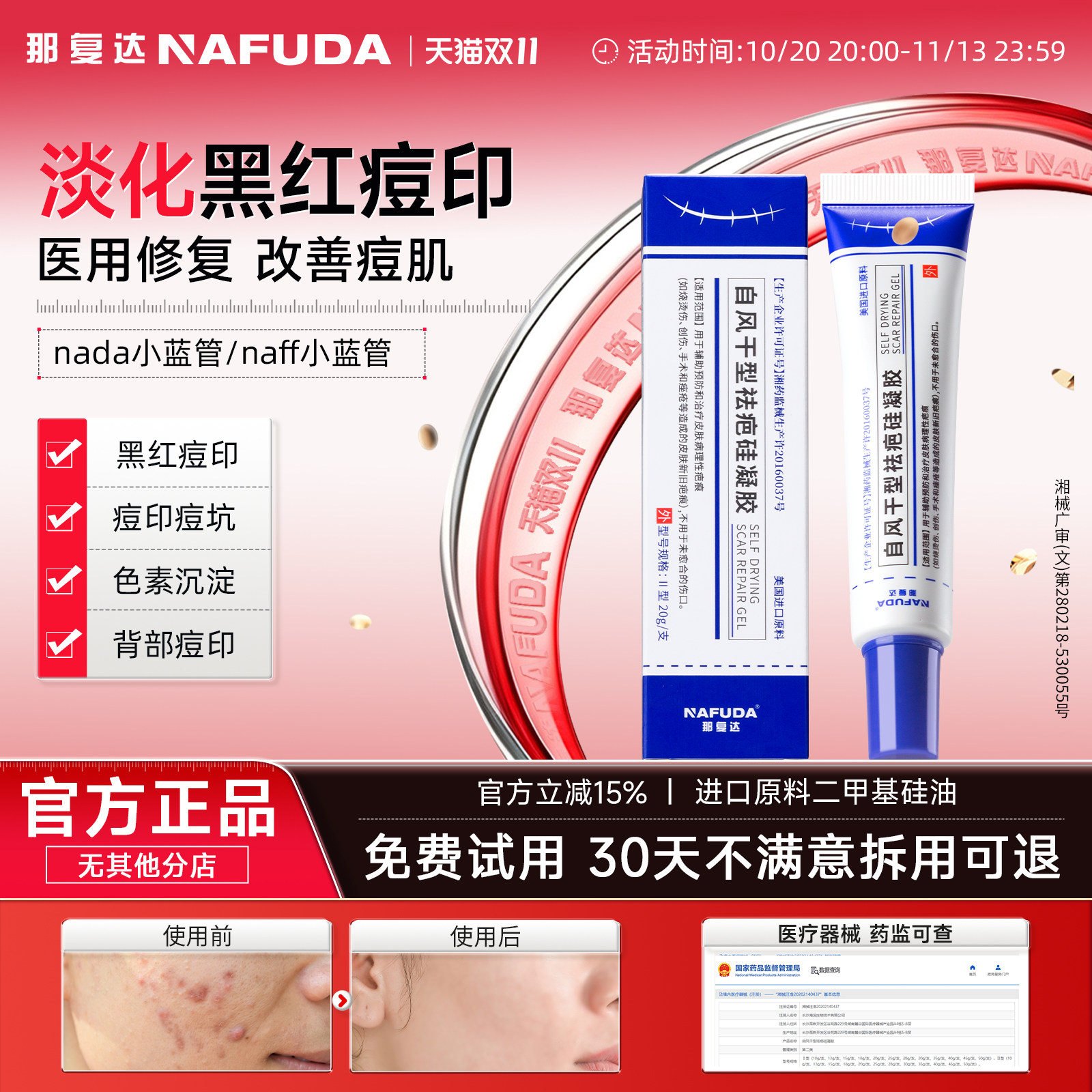 (活动新链接)naff小蓝管nada小蓝管淡化复达小蓝管痘印痘痘