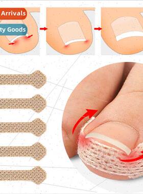 Ortho Nail Stickers Foot Crouching Nail Patch Ingrown Nails
