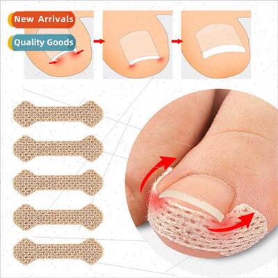 Ortho Nail Stickers Foot Crouching Nail Patch Ingrown Nails