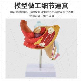 Male Internal Reproductive Pathology Model Lesion Male Repro