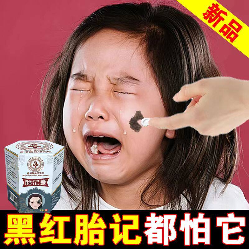香港儿童去胎记除胎记脸部神器黑色素青红胎记太田痣咖啡斑专用