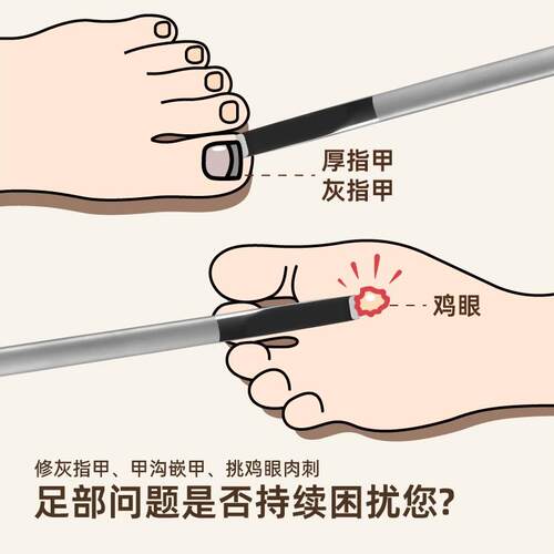 德国盖罗不锈钢修脚平口条刀修脚刀老茧甲沟挑肉刺工具家用