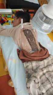 清积清热解表培元固本儿童草本灸