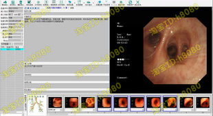 内镜软件高清版支气管镜高清工作站软件纤维支气管镜软件耳鼻喉镜