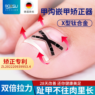德国BORSU甲沟嵌甲矫正器炎正甲贴片脚趾指甲往肉里长扎专用刀剪