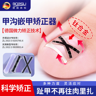 德国BORSU甲沟嵌甲矫正器炎正甲贴片脚趾指甲刀剪往肉里长专用贴