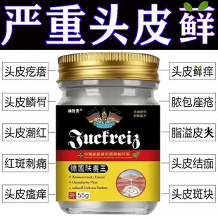 治头皮屑藓脂溢性皮炎牛皮银药去头部痒毛囊炎膏病真菌感染专用屑