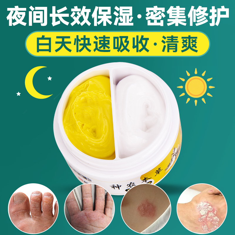 牛皮鲜银屑藓湿疹止痒膏