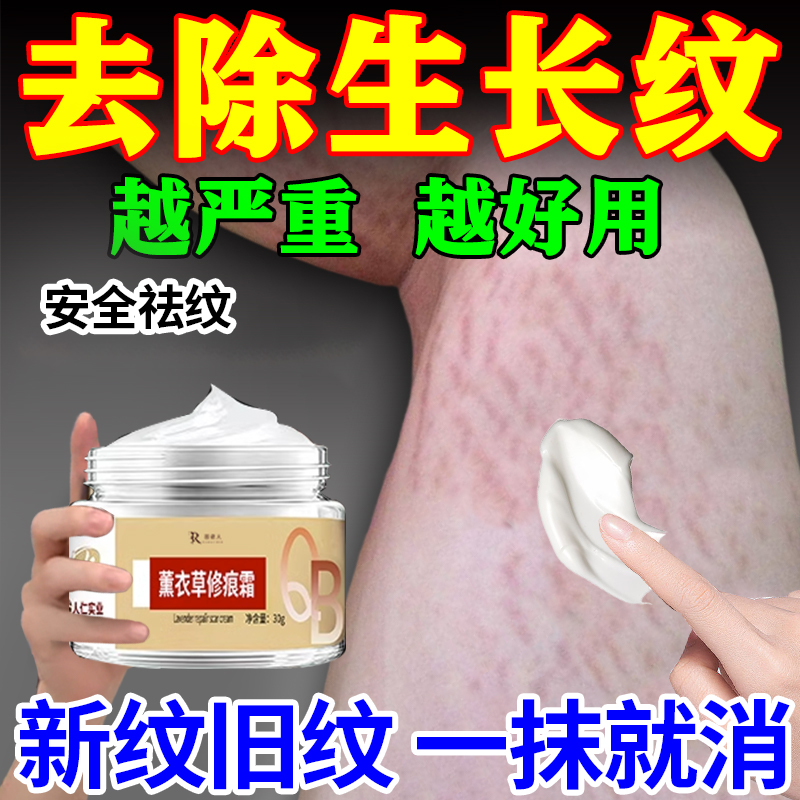去肥胖纹修复霜消除生长纹大腿学生腰腹上肥胖纹去除男女通用药膏