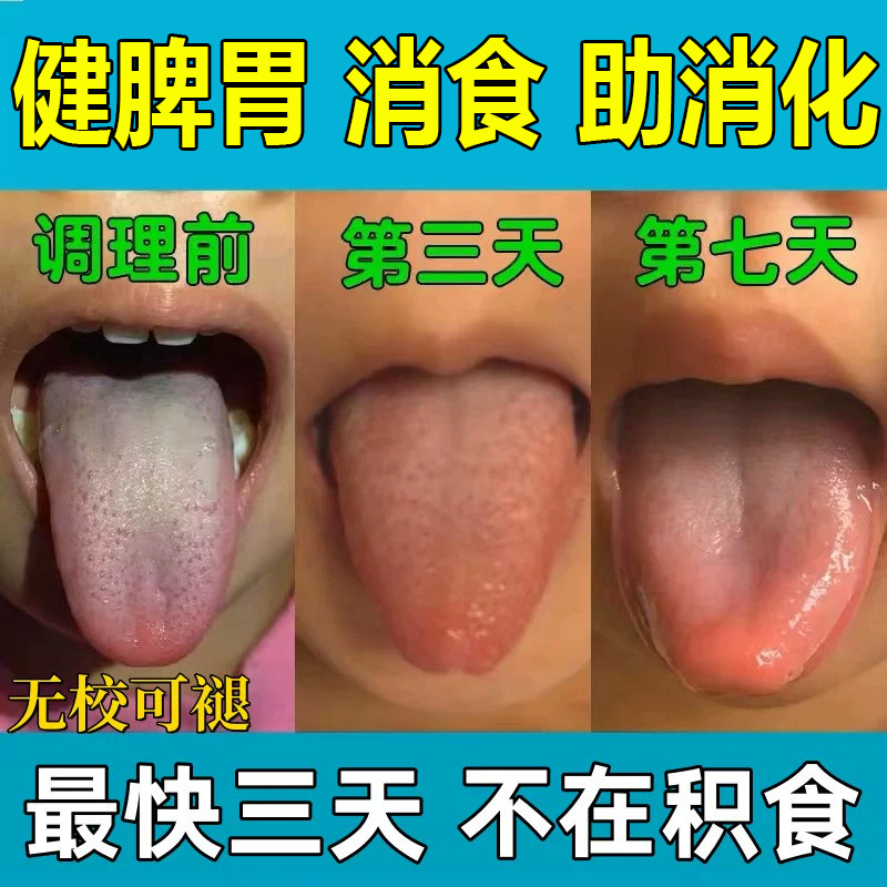 小儿化积食贴膏积食消食贴儿童健胃脾消鸡内金调理儿童消食肠胃贴,婴童洗护,宝宝贴,淘宝优惠券,粉丝福利购,淘宝优惠卷