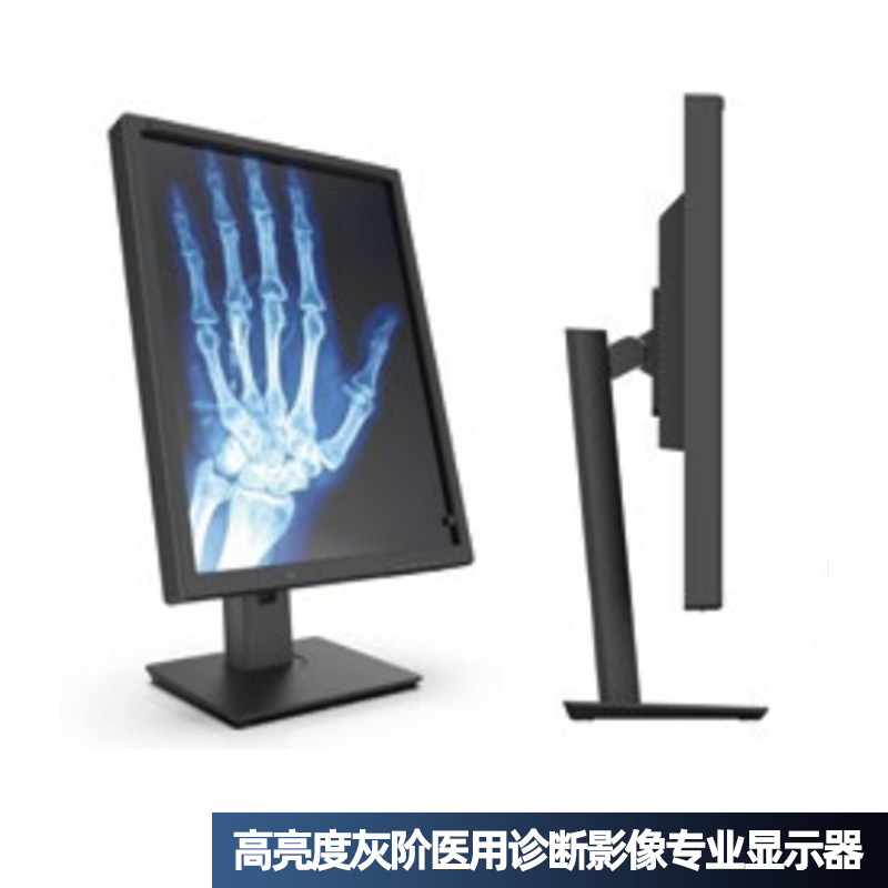 PHILIPS专业诊断显示器高亮度图片