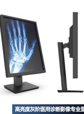 21.3英寸3M 5MP灰阶诊断显示器影像显示屏黑白 DICOM/GAMMA校准