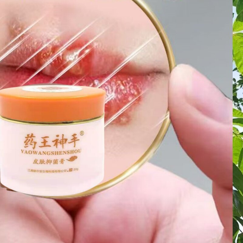 治嘴巴口角唇泡诊起皮上火起小水泡红肿痒糜烂干裂羊胡子疮药