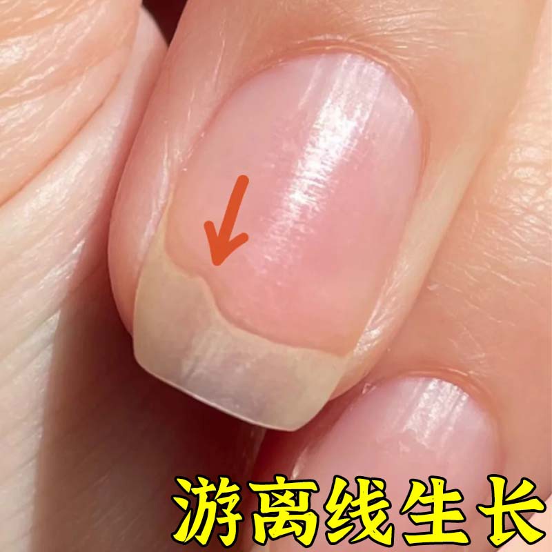 指甲游离线生长液指甲游离线生长液护甲油萎缩增长液延长营养油养