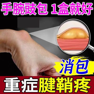 腱鞘消除膏健鞘囊中专用治疗手指疼手腕肿拇指关节疼痛僵硬舒筋膏