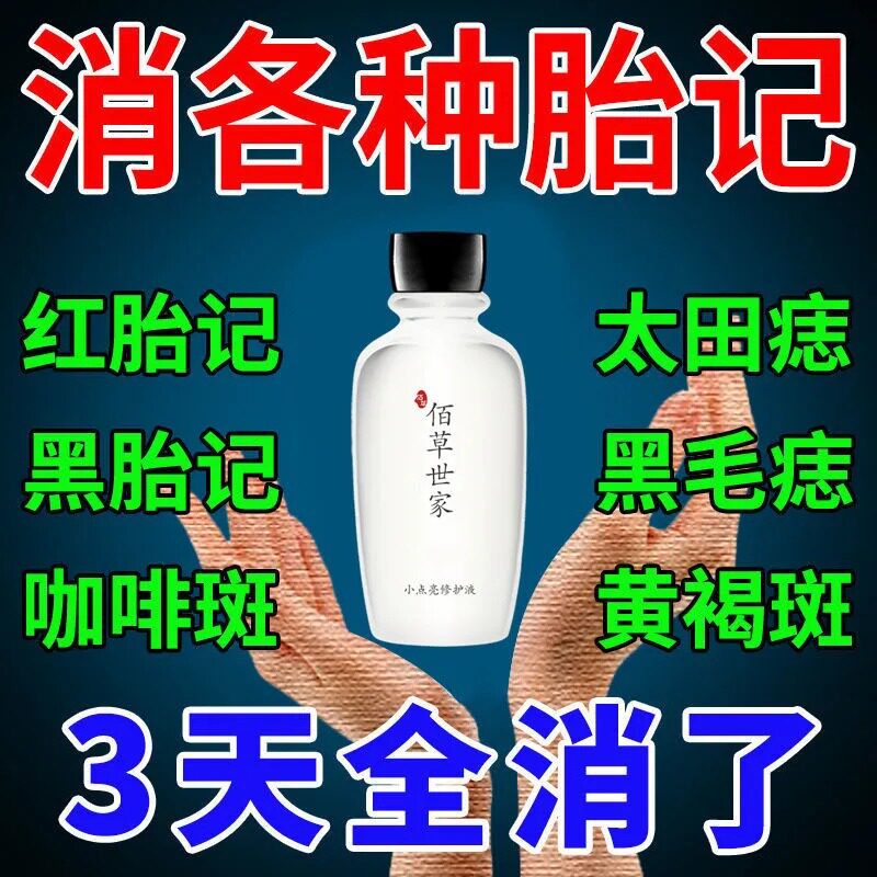 佰草世家消各种胎记】去胎记神器斑点霜去咖啡斑黑色素太田痣药膏