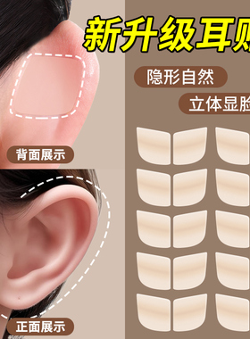 硅胶精灵耳贴耳朵支撑器隐形不痛显脸小立耳神器招风耳定型贴耳夹