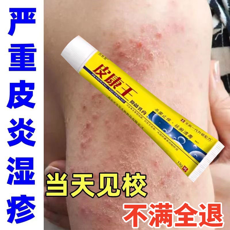 【哪里痒抹哪里】皮康王止痒软膏