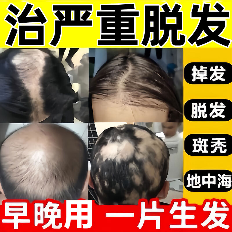 生发片滋补生发片白发增发脱落脱发防脱成人生发片QY
