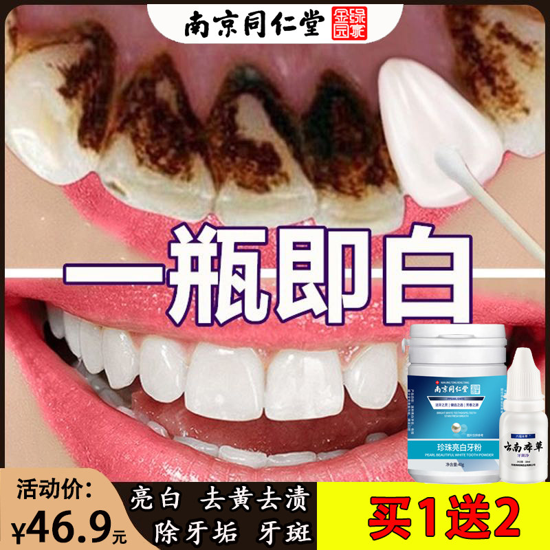 洗牙粉洗白去黄牙齿美白神器亮白速效去烟渍污垢黄除牙石黄牙结石