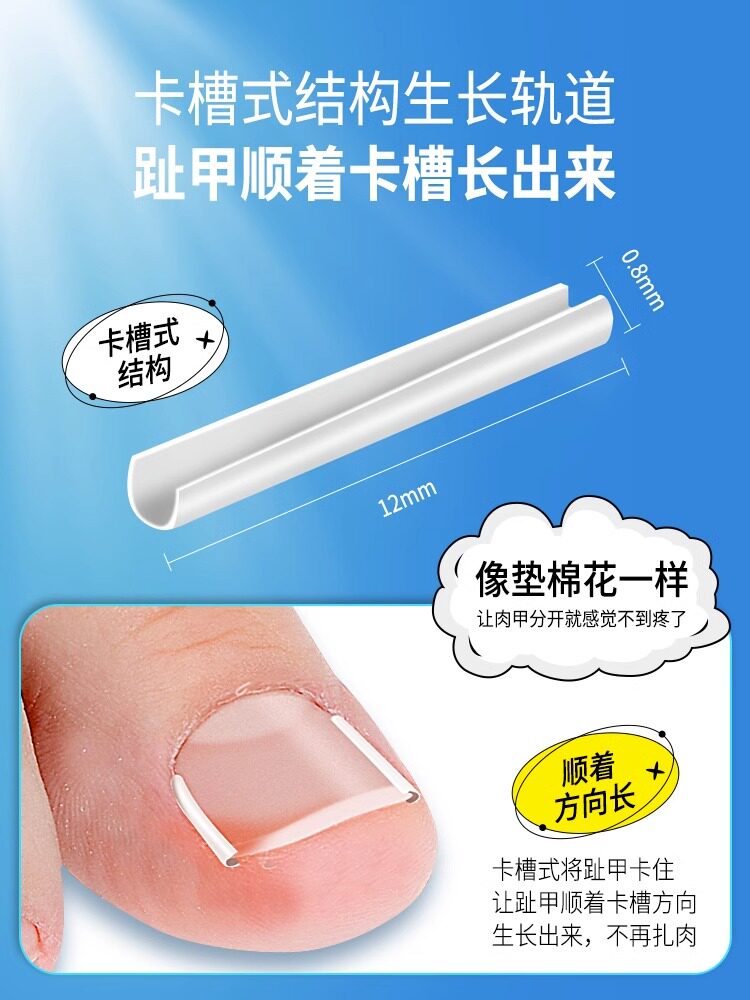 손톱 홈용 발톱 교정기 내생발톱 특수 격리 패드 발톱 교정 패치