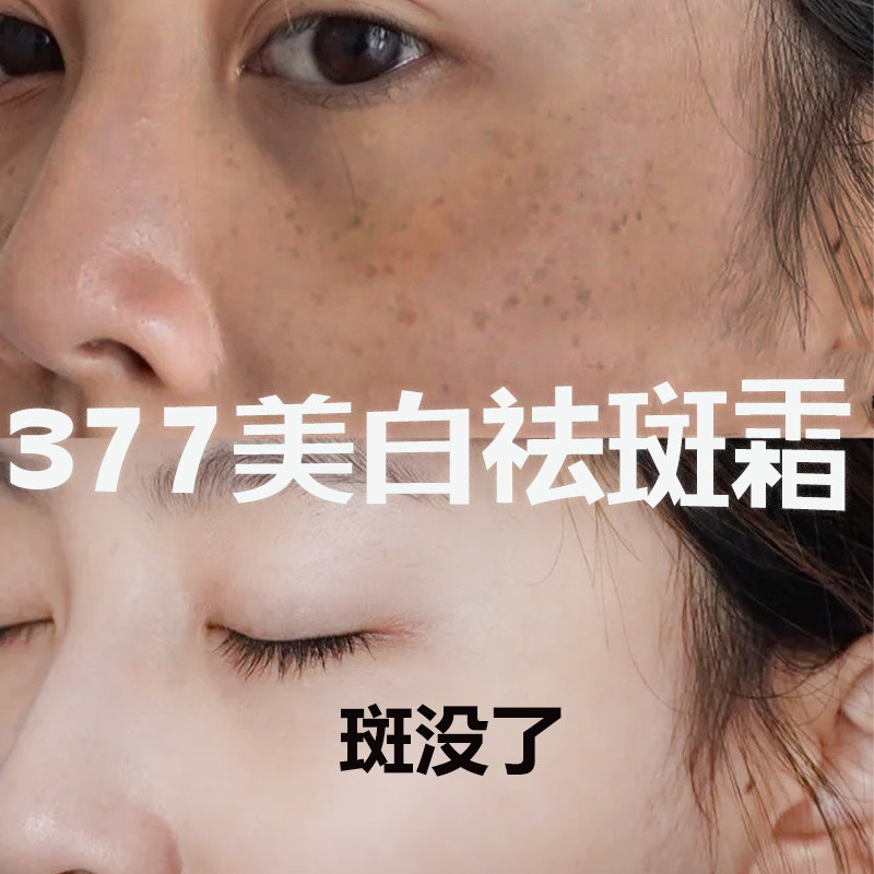 377五代断黑美白祛斑霜套装旗舰店正品祛黄褐斑雀斑淡化色斑官方