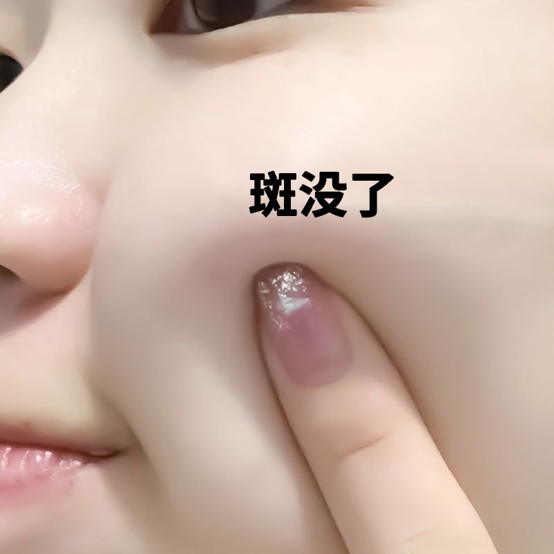 377断黑美白祛斑霜官方旗舰店正品五代雀斑黄褐斑老年斑祛黑色素