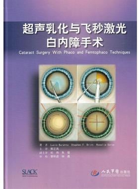 【正版】超声乳化与飞秒激光白内障手术 Lucio、Bura
