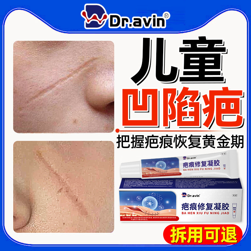 儿童凹陷性疤痕生长祛疤膏因子专用修小孩摔伤手术抓伤除疤膏QQ