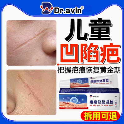 儿童凹陷疤痕【医用级】