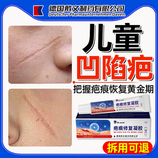 儿童凹陷性疤痕生长祛疤膏因子专用修小孩摔伤手术抓伤除疤膏QQ