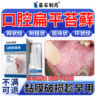口腔扁平苔藓黏膜修复扁平苔癣专用喷剂白斑纤维化辅治疗修复液SE