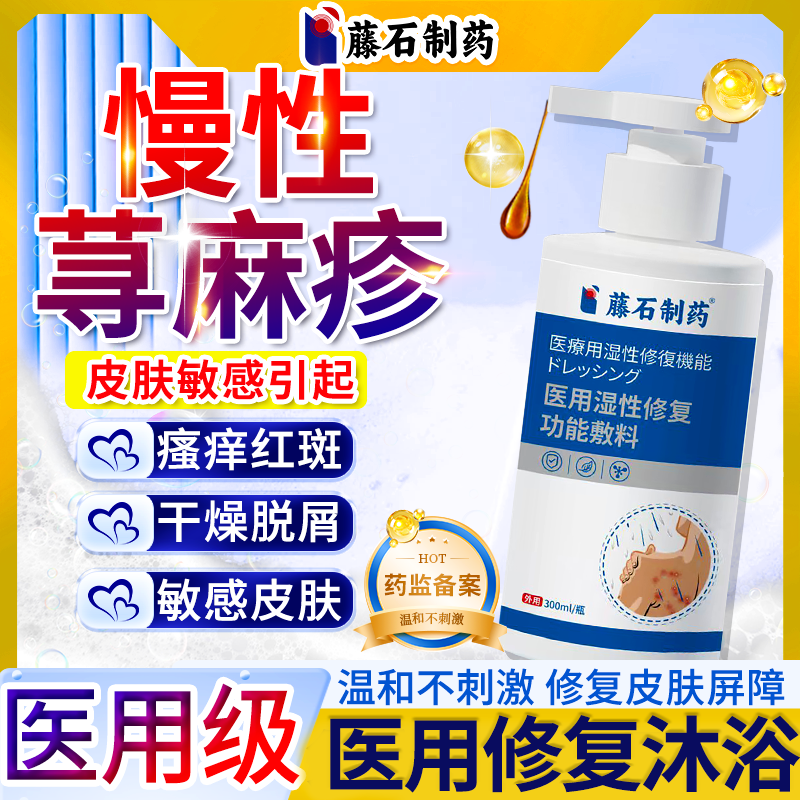 过敏性慢性胆碱性寻荨麻疹过敏止痒根提高免疫力止痒膏非沐浴露CS