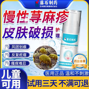 儿童可搭急慢性寻荨麻疹过敏止痒喷雾止痒膏根提高免疫力CS