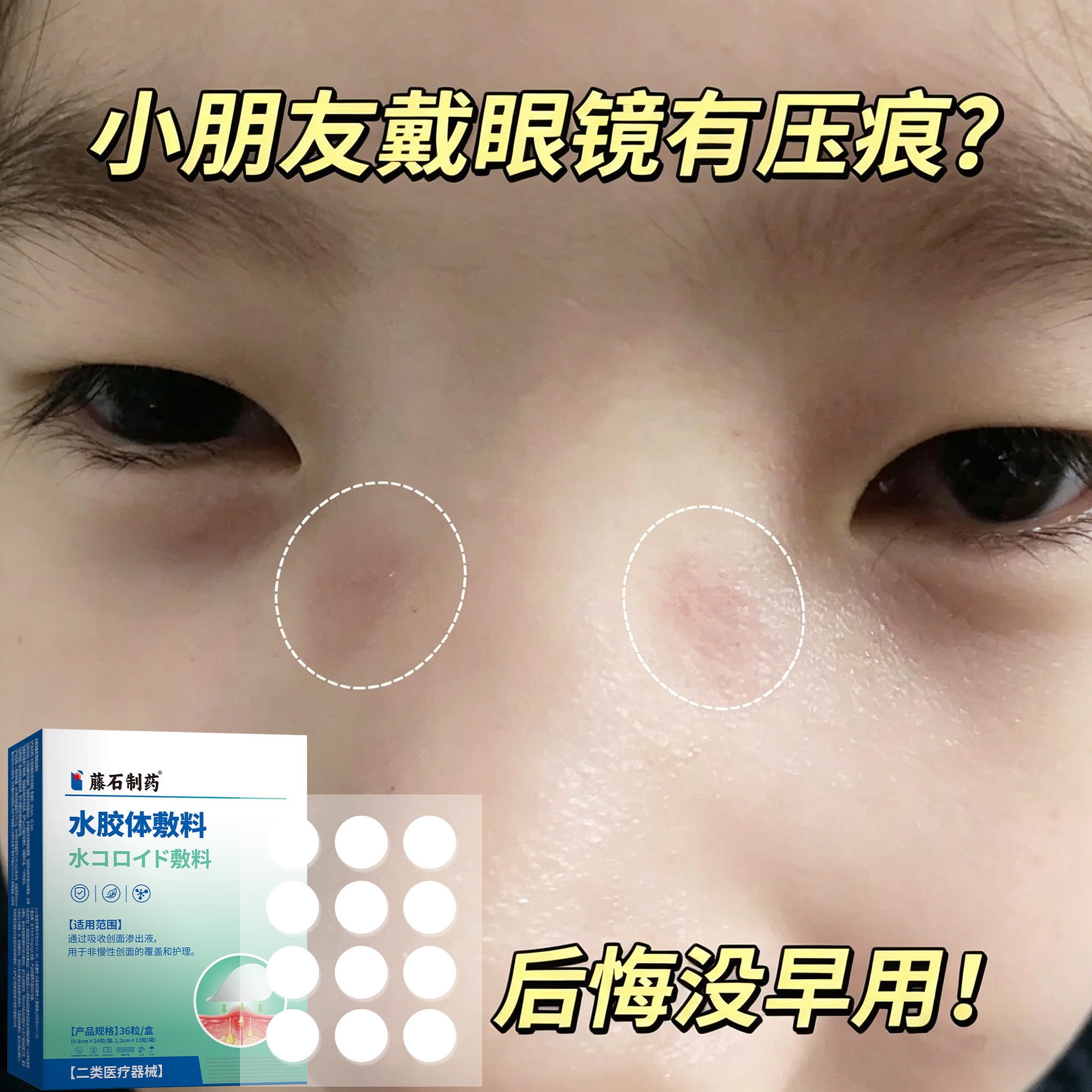 儿童小儿戴眼镜不压鼻梁神器鼻托防压痕防压垫鼻贴消除防滑贴LJ