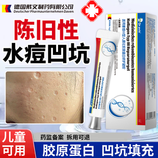 凹陷性水痘疤痕修复去水痘坑填充生长因子痘坑凹洞儿童祛疤膏QQ