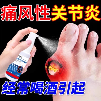 【正品保障】痛风性骨关节炎