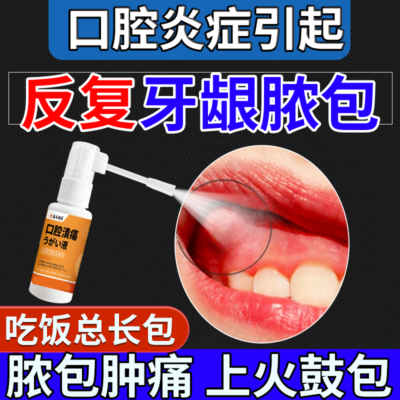 儿童可搭上火牙龈脓包肿包专牙根尖囊肿发肿痛炎消药监备案用CS