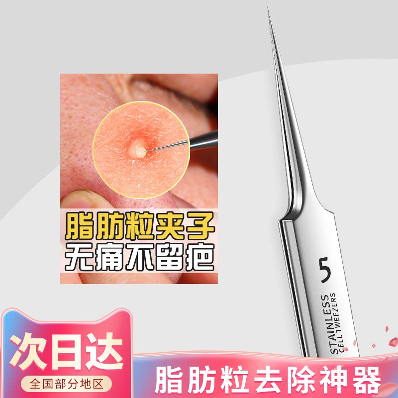 脂肪粒去除神器挑眼睛眼周眼膜眼角眼部眼下脂肪粒细胞夹去除针