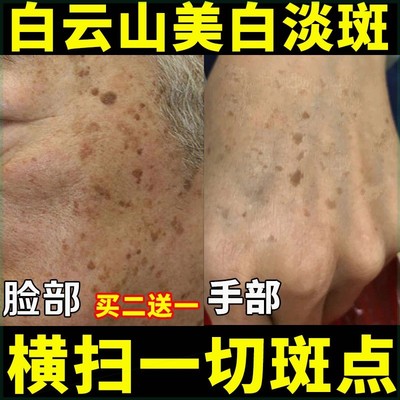 美白祛斑面霜淡化祛去色斑黄褐斑雀斑老年斑官方旗舰店正品第一名