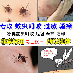 痱子去痱蚊虫叮咬儿童皮肤过敏大人止痒外用瘙痒消红肿祛疤药膏