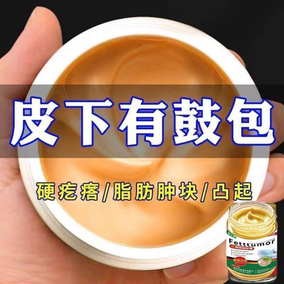 顽固脂肪瘤软膏消皮下肿块硬块单发性多发性脂肪瘤粉瘤囊肿专用