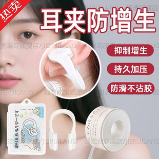 防增生耳夹可调压力术后专用防疤痕疙瘩耳垂夹透气防过敏可视化