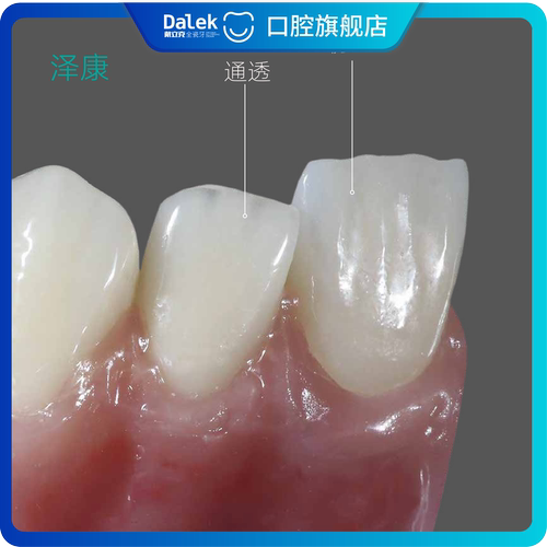 德国泽康全瓷牙二氧化锆牙冠进口瓷牙套修复缺牙美观耐用全国门店