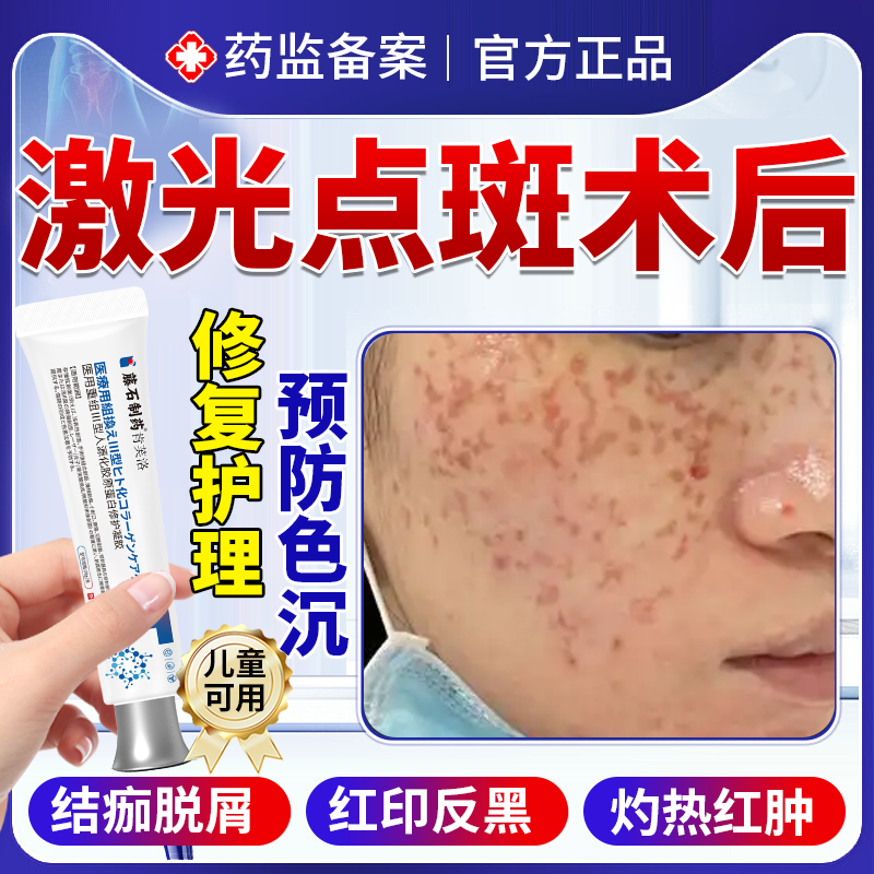 激光术后修复凝胶点痣点斑专用修复液祛斑后产品膏非面膜去红印YS