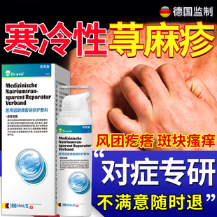 寒冷性荨麻疹膏寻麻疹过敏止痒断提高免疫力根慢性丘疹风团瘙痒YM